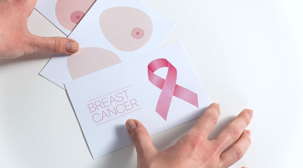 Cancro mama informação